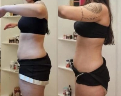 Antes e depois — aluna do Desincha 15
