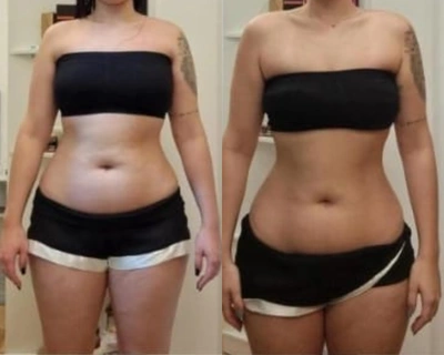 Antes e depois — aluna do Desincha 15